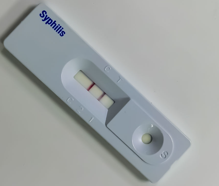 Σύμβιδος αντιγόνο ταχείας δοκιμής δοκιμής
